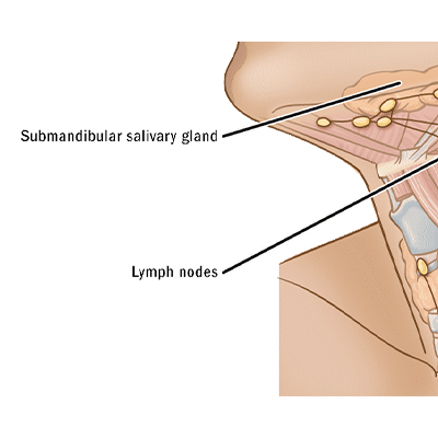Throat Cancer Surgery in KPHB